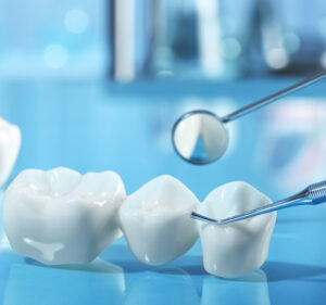 Dental Implants Vs. Fixed Bridges 